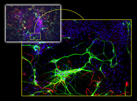 Rat Brain