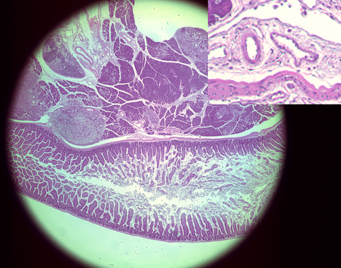 Small Intestine